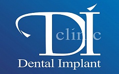 Dental Implant